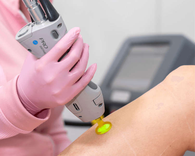 Depilacion Laser Pierna completa