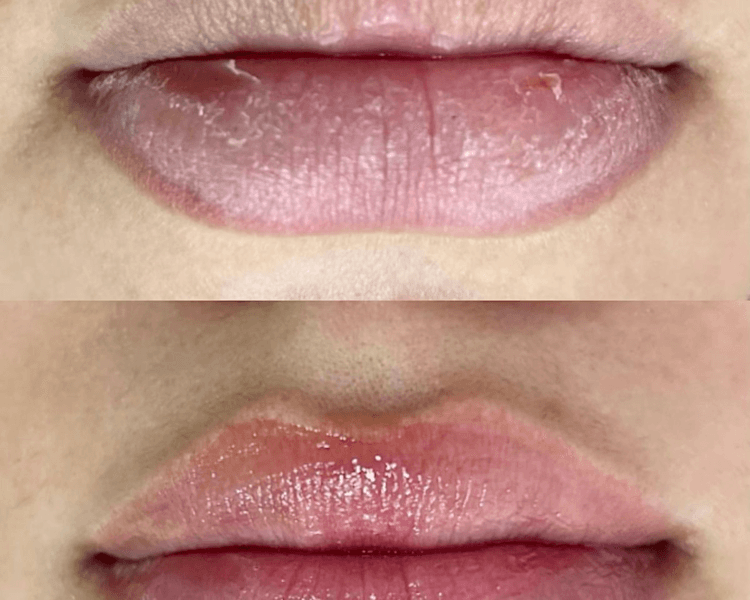 HIDRA GLOSS ( HIDRATACION DE LABIOS)