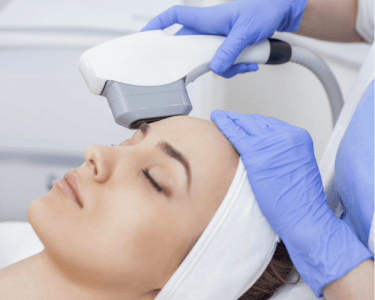 Fototerapia IPL · Tratamiento Acné — Cara Completa