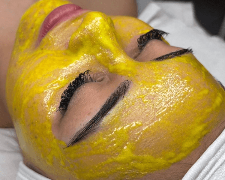 Yellow Peel