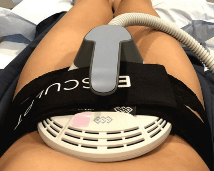 💪EMSCULPT 1 ZONA - 4 SESIONES
