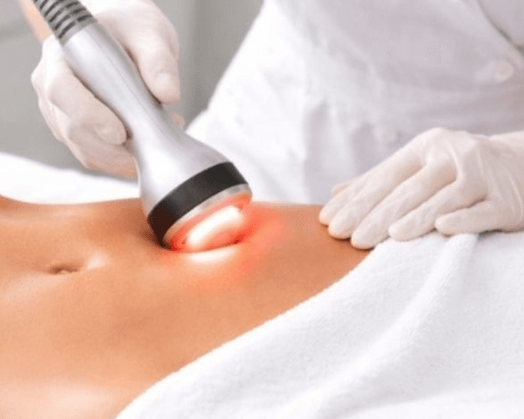 Radiofrecuencia facial/corporal