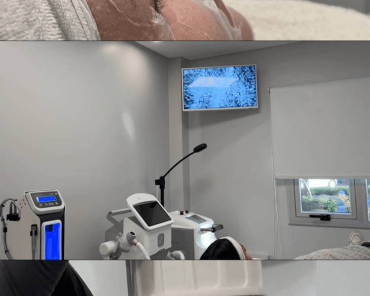 ACNE BALANCE | Peeling Mesoestetic