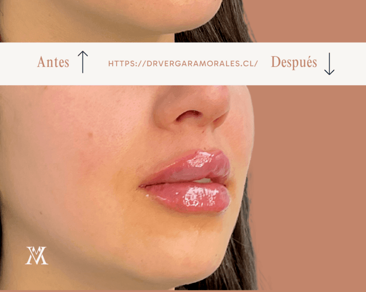 Labios que sueñas, en the nook
