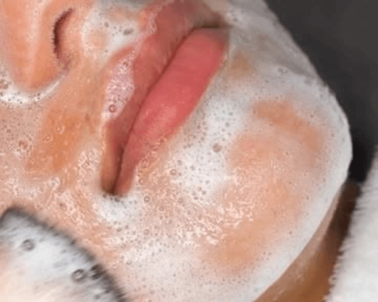 LIMPIEZA FACIAL PROFUNDA