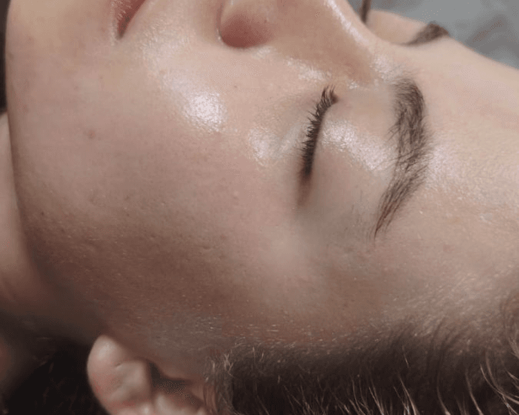 Limpieza facial profunda