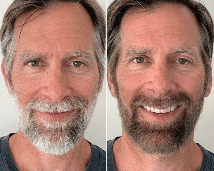 Tinte de Barba