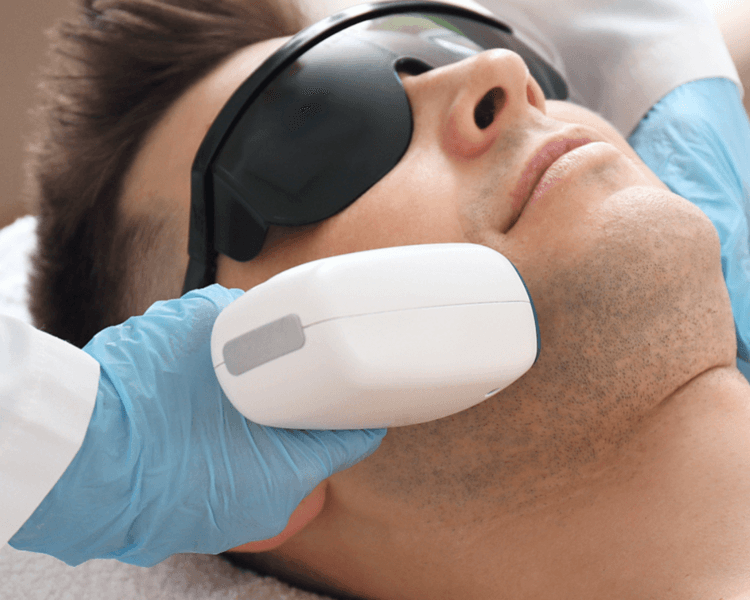 Perfilado de barba 12 sesiones