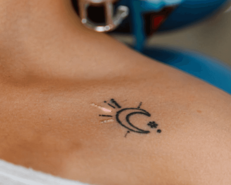 Evaluación Borrado de Tatuajes - Tattoo Clinic