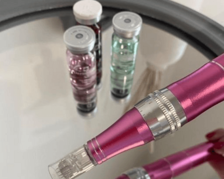 Dermapen con vitaminas (1 sesión)
