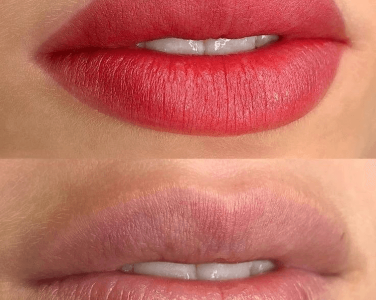 Full lips