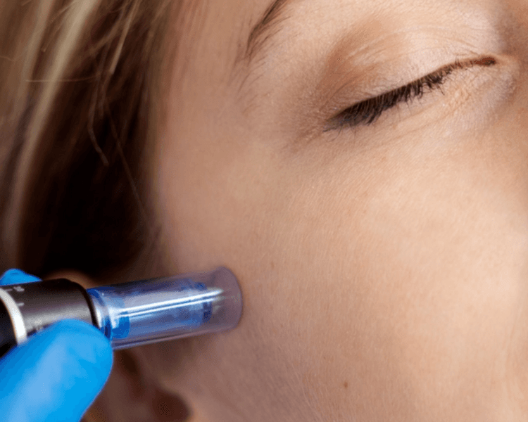 Dermapen