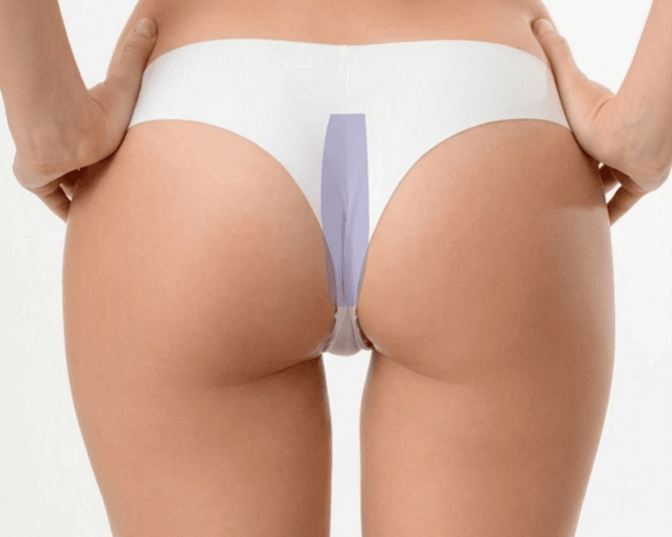 Cera perianal