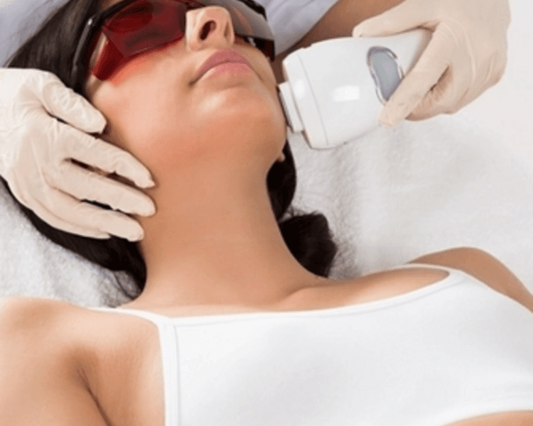 Láser facial
