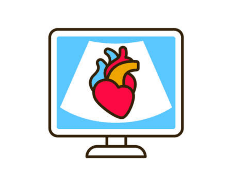 Ecocardiograma