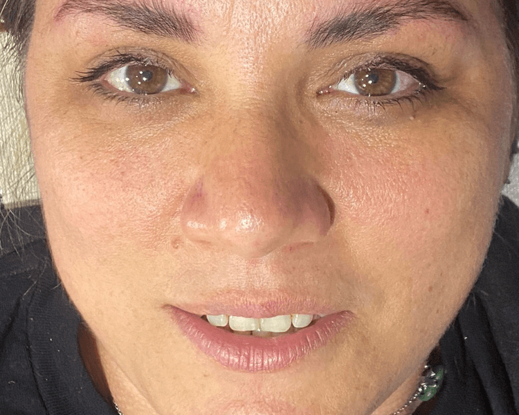 Laminado de cejas