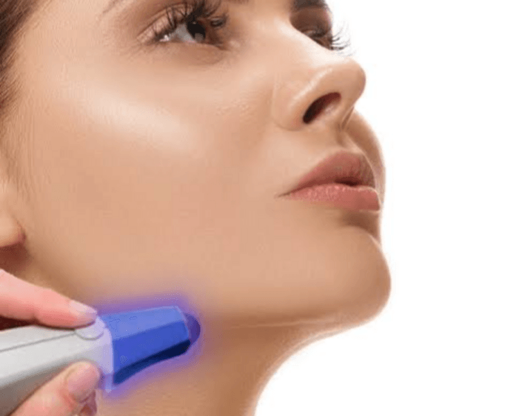 Rostro completo 6 sesiones