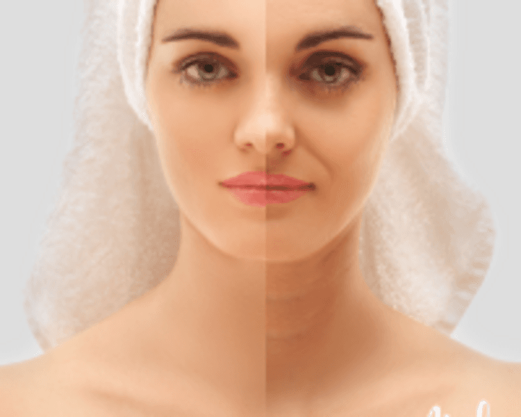 HIGIENE FACIAL FULL CHAU MANCHAS