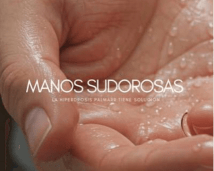 Hiperhidrosis Palmar