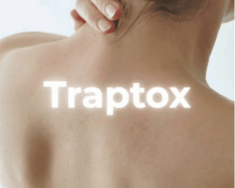 Traptox