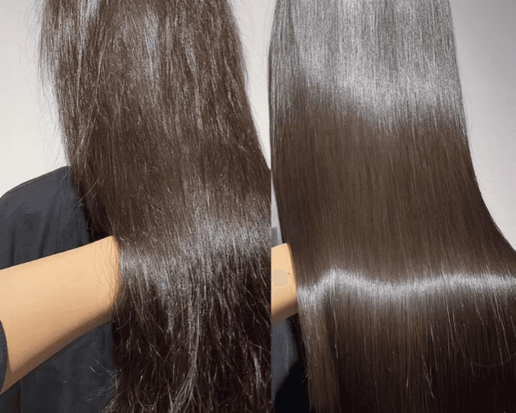 Ultrashine therapy