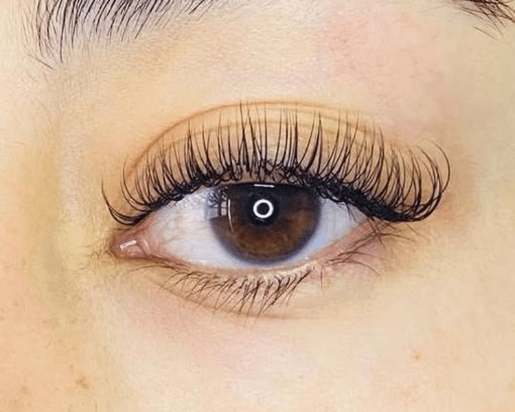 Extensiones Clasicas