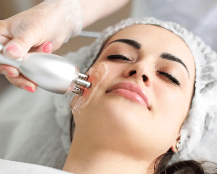 Radiofreciencia facial