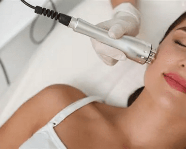Limpieza facial profunda + radiofrecuencia