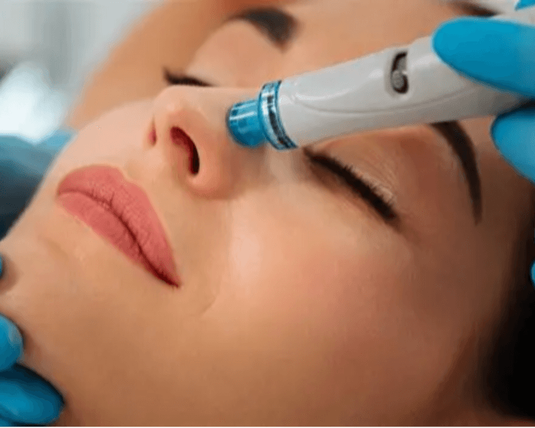 Limpieza facial profunda con hidrafacial + cuello + escote