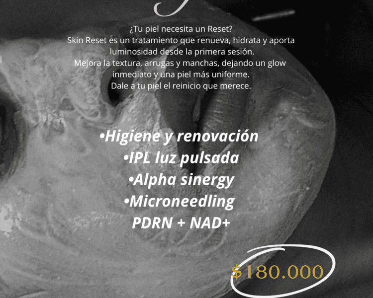 Reset facial 😍⚡️🔝