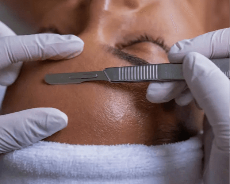 FACIAL Full Dermaplaning