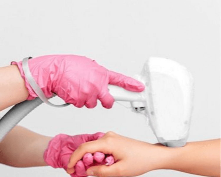 Depilacion laser