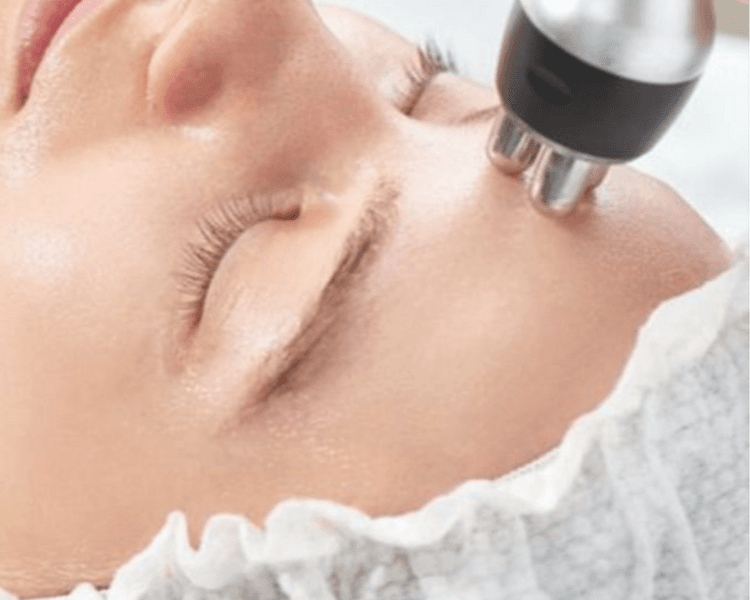 Radiofrecuencia facial