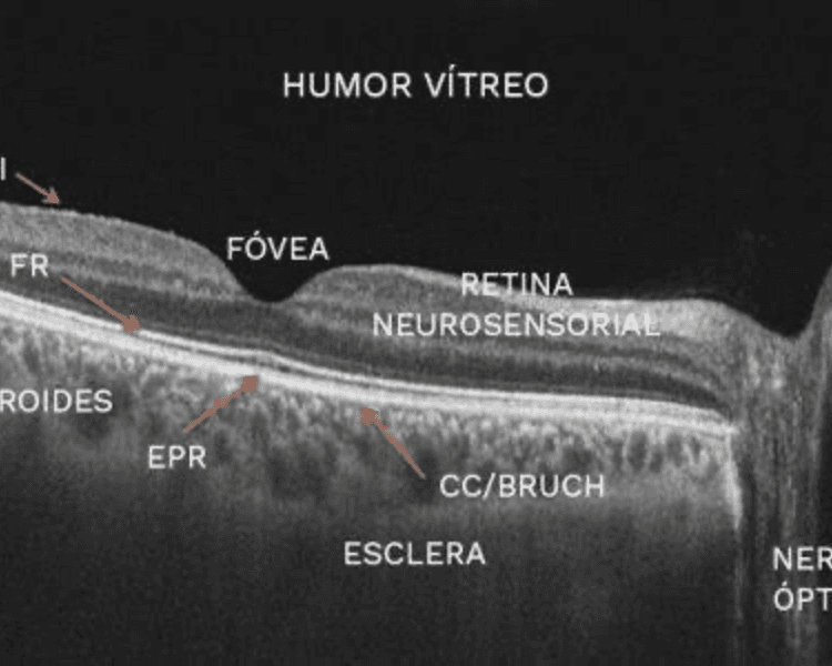 OCT TOMOGRAFIA DE COHERENCIA OPTICA BILATERAL FONASA