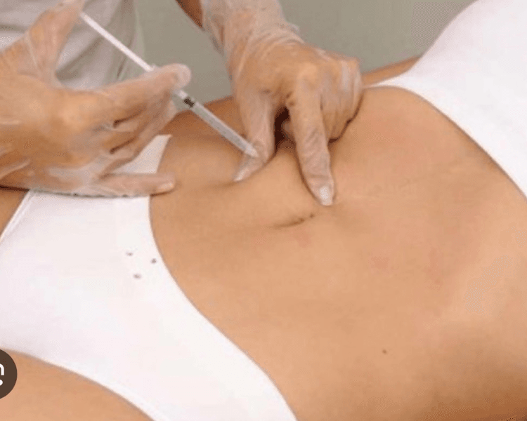 Inyecciones de lipoticos más drenaje (reductivo)