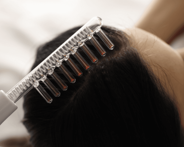 ESTIMULACION FOLICULAR