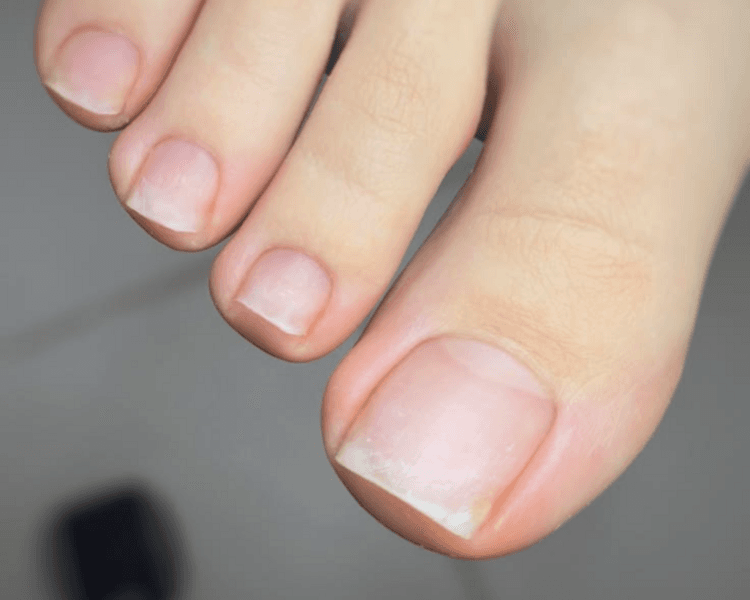 Pedicuria