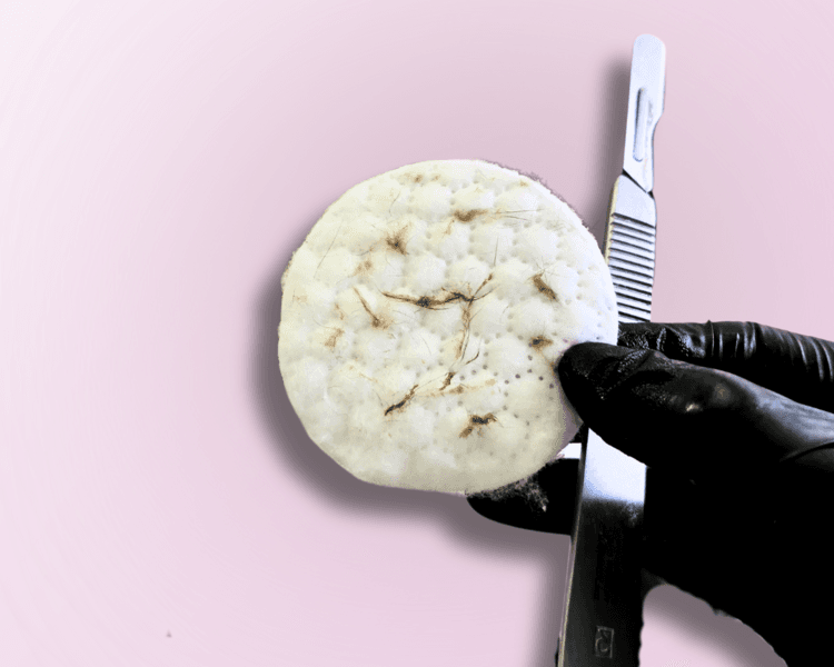 Limpieza facial profunda + DERMAPLANING + RADIOFRECUENCIA