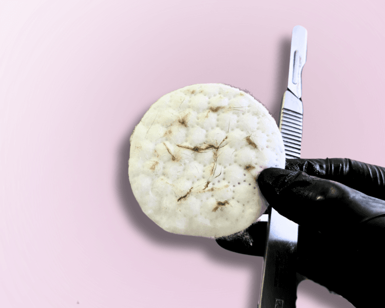 💣 Limpieza facial profunda + DERMAPLANING + RADIOFRECUENCIA + INFUSIÓN DE ACTIVOS (Dermapen)