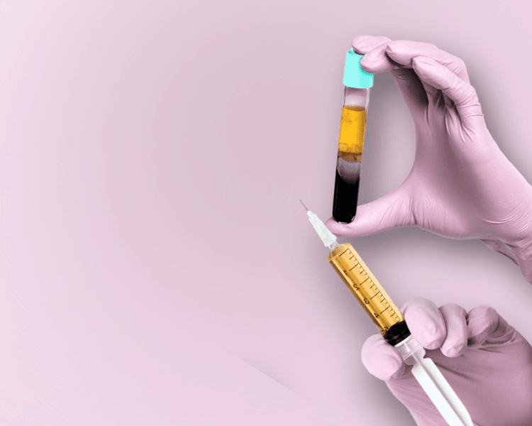 1 sesión Plasma rico en plaquetas + Mesoterapia (ROSTRO + PAPADA + CAPILAR)