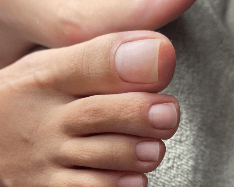 PEDICURE (LIMPIEZA🦶)