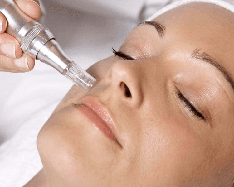 Dermapen facial con centella asiática (1 sesión)