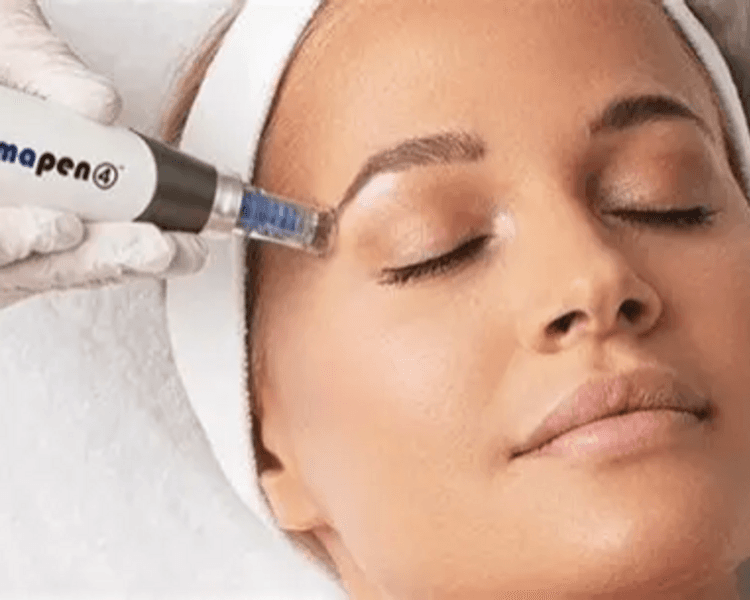 HYDRAFACIAL + MICRONEEDLING