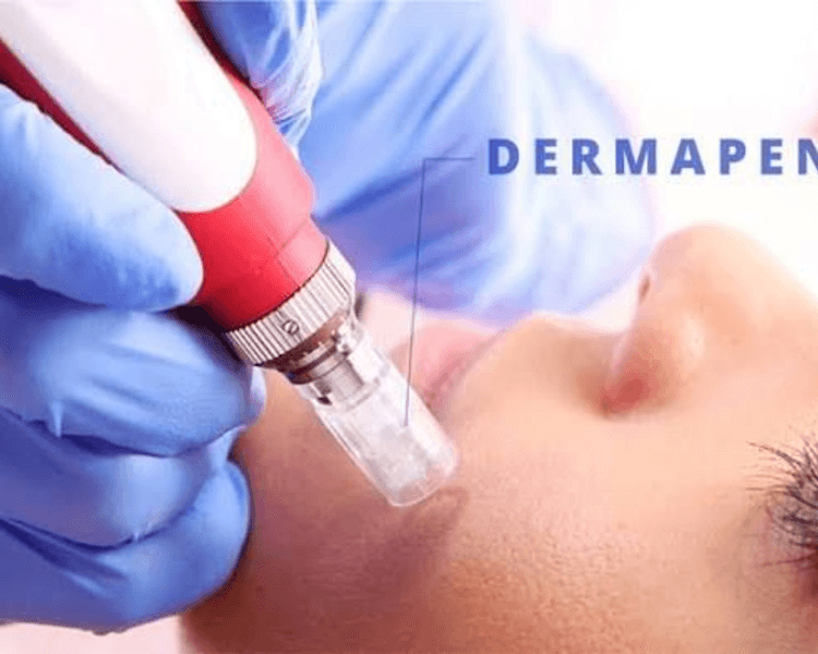 Pack Dermapen (3 sesiones)