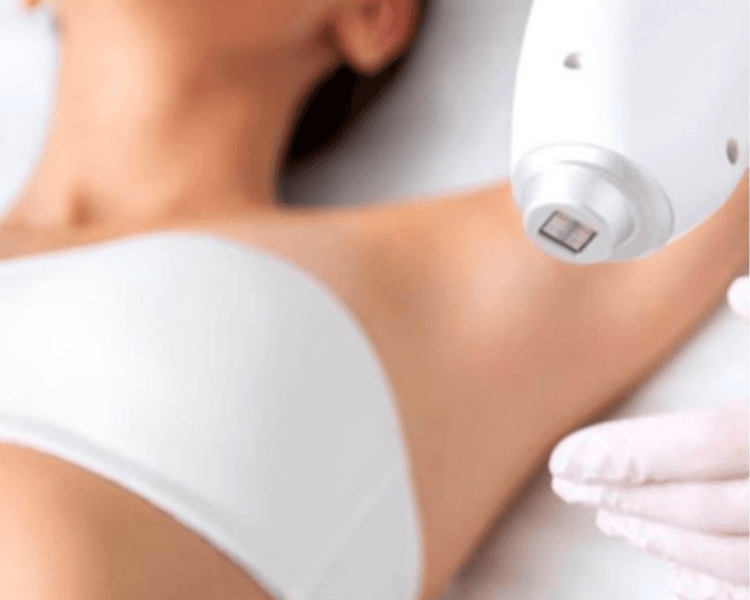 PROMO DEPILACION LASER PIERNAS, REBAJE BRASILEÑO Y AXILAS (8 SESIONES) ANTES 287.500