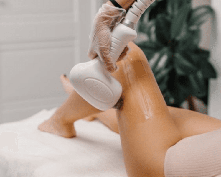DEPILACION LASER PIERNAS COMPLETAS (8 SESIONES) ANTES 225.000