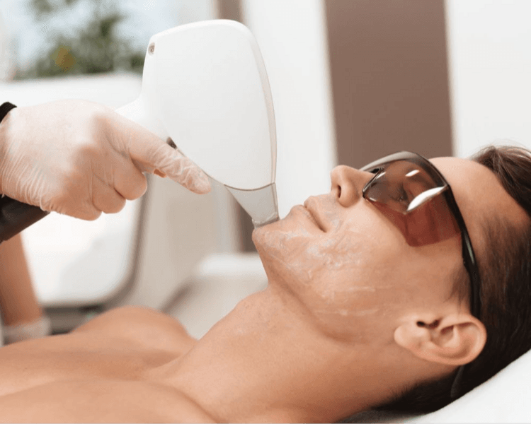PROMO DEPILACION LASER ROSTRO COMPLETO (8 SESIONES) ANTES 130.000