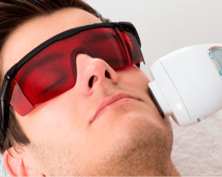 PROMO DEPILACION LASER BARBA PARA HOMBRES (8 SESIONES)