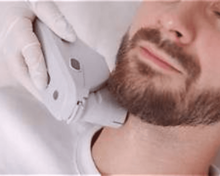 DELINEADO DE BARBA PARA HOMBRES (8 SESIONES)