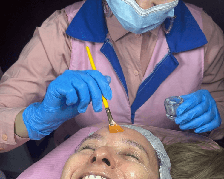 Peeling Quimico Cosmiatrico